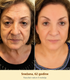 Pčelinji Otrov Krema - Anti-Age Serum