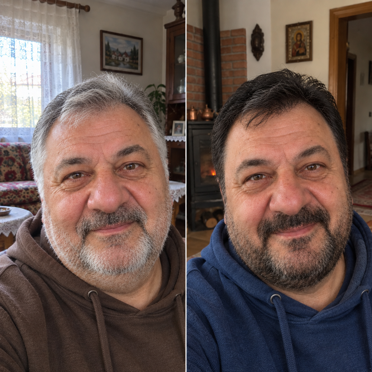 Crni sapun za Sedu Kosu +  Poklon Kutija za sapun
