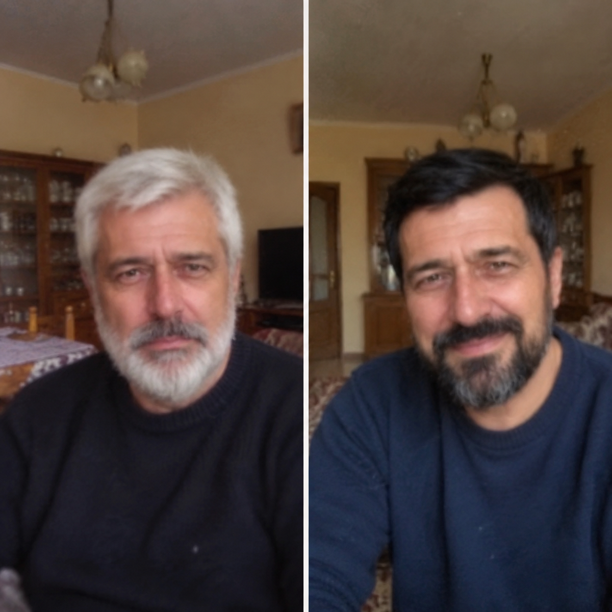 Crni sapun za Sedu Kosu +  Poklon Kutija za sapun