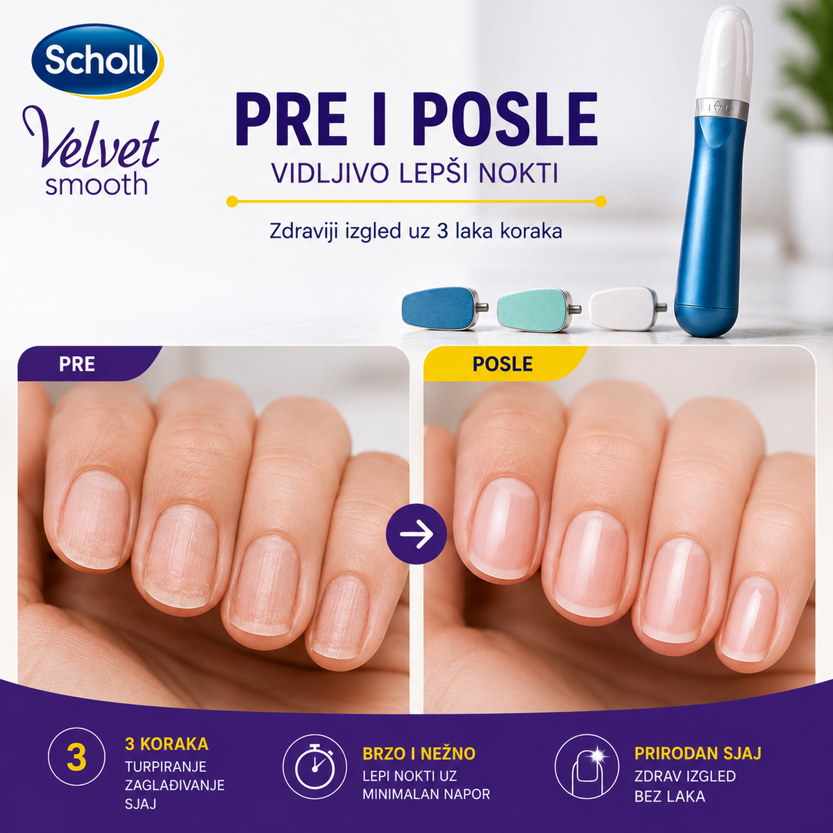 Scholl 3u1 električni set za nokte