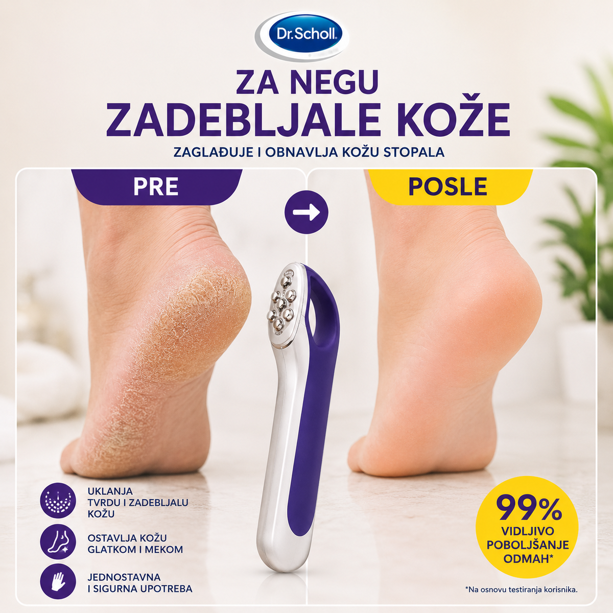 Scholl turpija za tvrdu kožu stopala