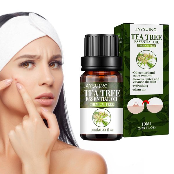 TEA TREE OIL &#8211; Ulje protiv akni